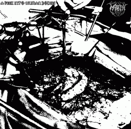 A Peek into Human Bodies